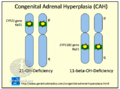 Congenital Adrenal Hyperplasia CAH (DermNet NZ Congenital-Adrenal-Hyperplasia-CAH).png