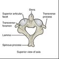 Bones and ligaments of the vertebral column (illustrations) (Radiopaedia 42770-45935 I 1).jpg