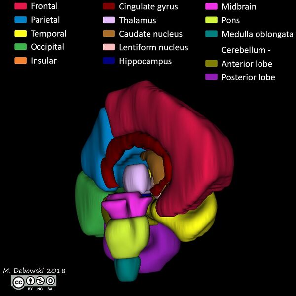 File:Brain lobes - annotated MRI (Radiopaedia 61691-69700 3D reconstruction 11).JPG