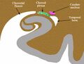 Choroidal fissure (diagram) (Radiopaedia 59364-97485 Coronal plane 1).jpg