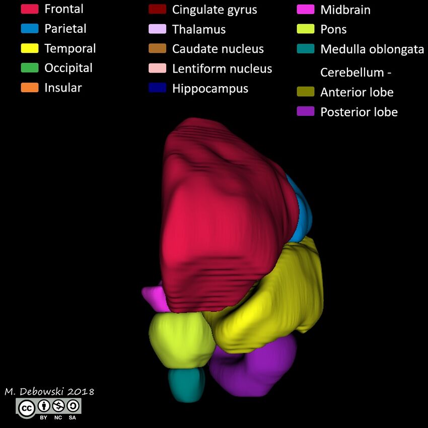 Brain lobes - annotated MRI (Radiopaedia 61691-69700 3D reconstruction 20).JPG