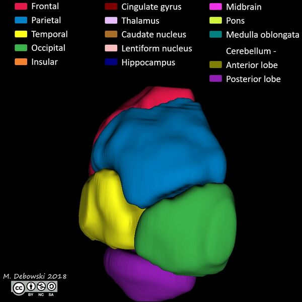 File:Brain lobes - annotated MRI (Radiopaedia 61691-69700 3D reconstruction 58).JPG