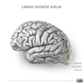 Neuroanatomy- lateral cortex (diagrams) (Radiopaedia 46670-51201 I 2).png