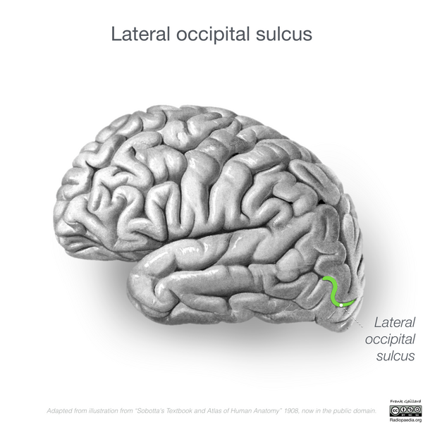 File:Neuroanatomy- lateral cortex (diagrams) (Radiopaedia 46670-51201 I 2).png