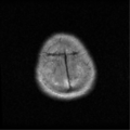 Thumbnail for version as of 05:53, 2 April 2021