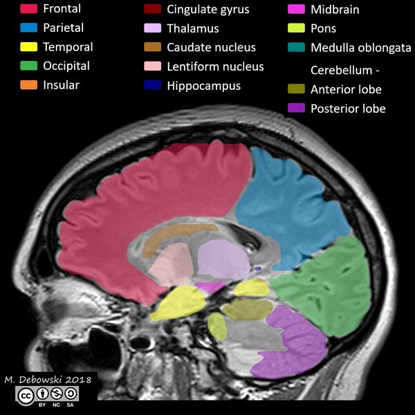 File:Brain lobes - annotated MRI (Radiopaedia 61691-69700 Sagittal 49).JPG