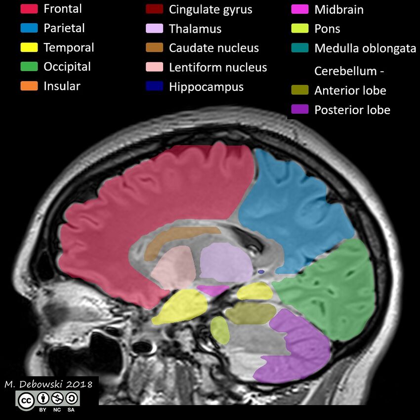 Brain lobes - annotated MRI (Radiopaedia 61691-69700 Sagittal 49).JPG