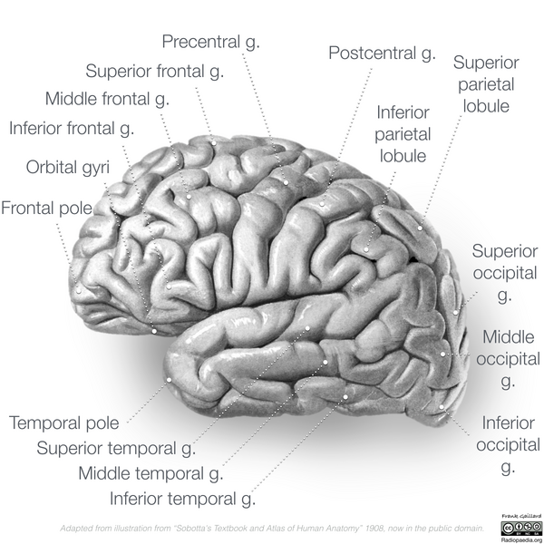 File:Neuroanatomy- lateral cortex (diagrams) (Radiopaedia 46670-51313 Gyri 3).png