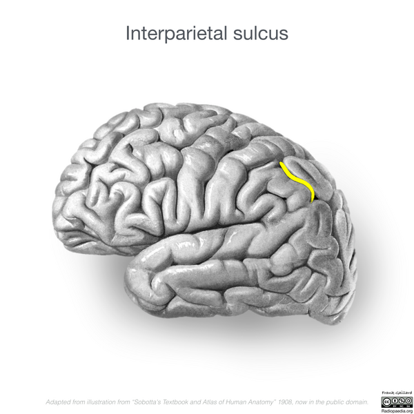 File:Neuroanatomy- lateral cortex (diagrams) (Radiopaedia 46670-51202 Interparietal sulcus 2).png