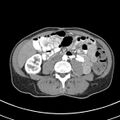 Normal multiphase CT liver (Radiopaedia 38026-39996 B 50).jpg