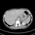 Normal multiphase CT liver (Radiopaedia 38026-39996 C 16).jpg
