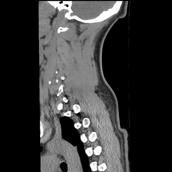 File:Normal trauma spine imaging (Radiopaedia 31753-32686 A 35).jpg