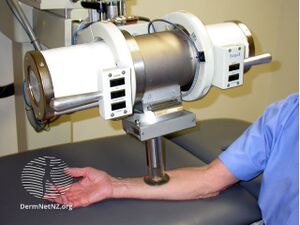 Radiation therapy being administed to a skin cancer on the arm (DermNet NZ procedures-radiotherapy3).jpg