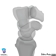 Normal bone alignment