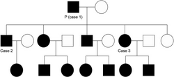 Pedigree of family with generalized Dowling-Degos disease (DDD). Father (P), first son (case 2), and second daughter (case 3) with DDD