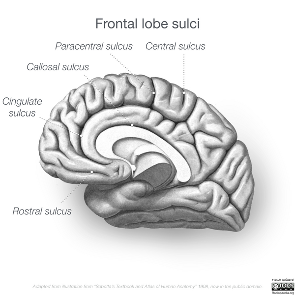 File:Neuroanatomy- medial cortex (diagrams) (Radiopaedia 47208-58969 C 2).png