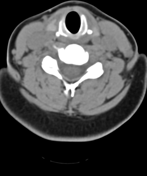 File:Normal cervical spine MRI (including Dixon) (Radiopaedia 42762-45926 Axial non-contrast 36).png