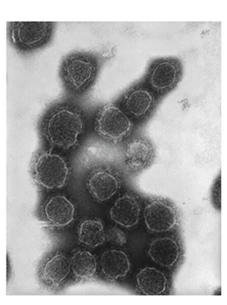 File:Peribunyavirus virion structure (1).jpg