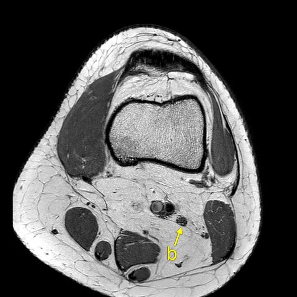 File:Anatomy Quiz (MRI knee) (Radiopaedia 43478-46866 A 3).jpeg