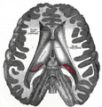 Anatomy of the lateral ventricles (Gray's illustration) (Radiopaedia 81785).png