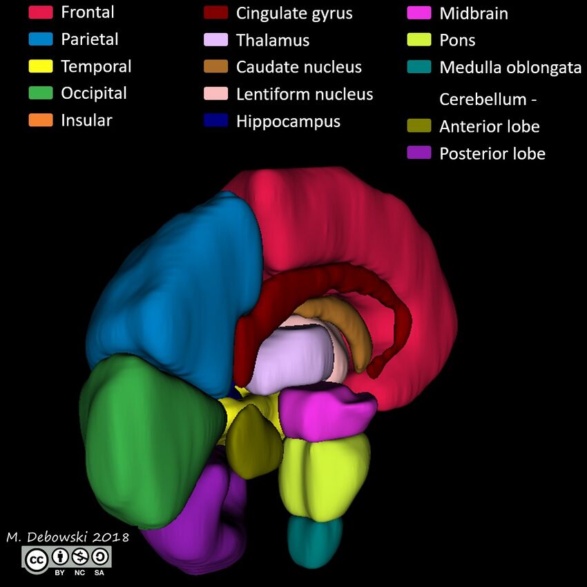 Brain lobes - annotated MRI (Radiopaedia 61691-69700 3D reconstruction 74).JPG