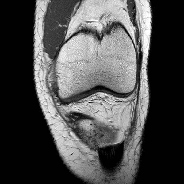 File:Anatomy Quiz (MRI knee) (Radiopaedia 43478-46874 A 8).jpeg