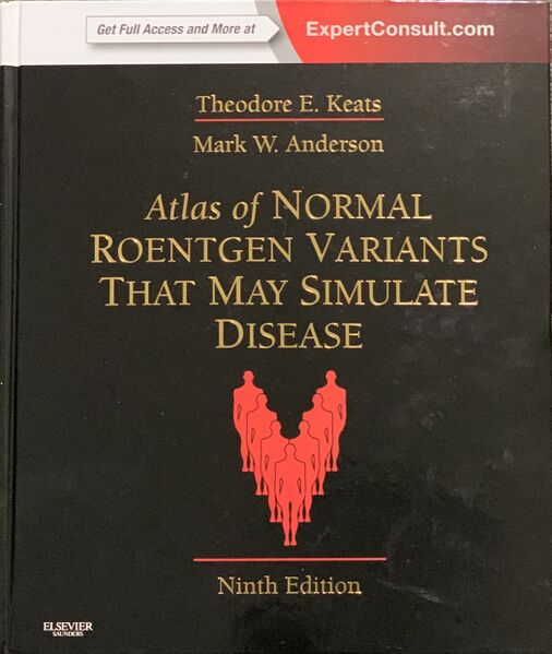 File:Atlas of Normal Roentgen Variants That May Simulate Disease- 9th edition (photograph) (Radiopaedia 72242).jpeg