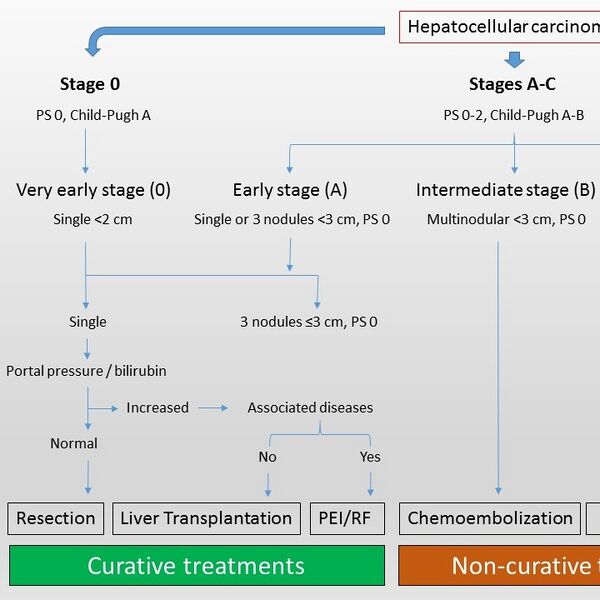 File:Barcelona clinic liver cancer (BCLC) staging classification (Radiopaedia 34365-35652 None 2).jpg