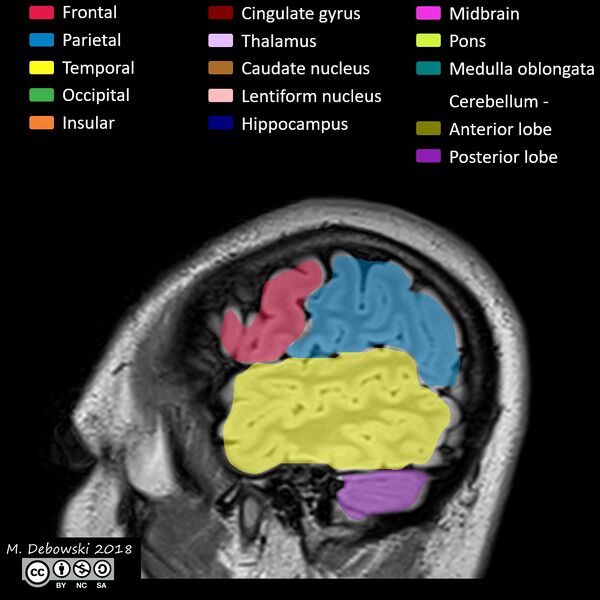 File:Brain lobes - annotated MRI (Radiopaedia 61691-69700 Sagittal 71).JPG