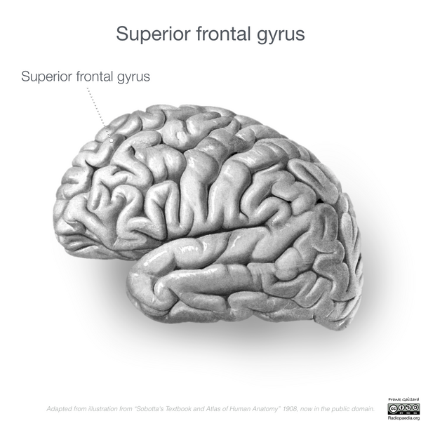 File:Neuroanatomy- lateral cortex (diagrams) (Radiopaedia 46670-51313 D 2).png
