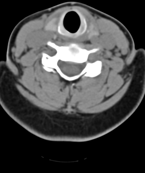 File:Normal cervical spine MRI (including Dixon) (Radiopaedia 42762-45926 Axial non-contrast 37).png