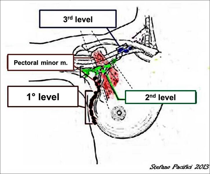 File:Axillary lymph node anatomy (Radiopaedia 25752).jpg