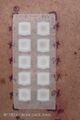 Patch tests applied to skin of upper back (DermNet NZ patch-test-series-013).jpg