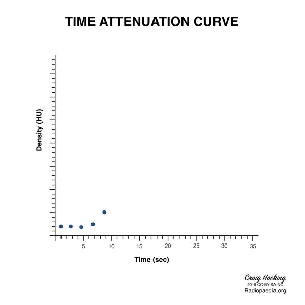File:Brain perfusion - time attenuation curves (Radiopaedia 70313-80395 Curve generation 6).jpeg