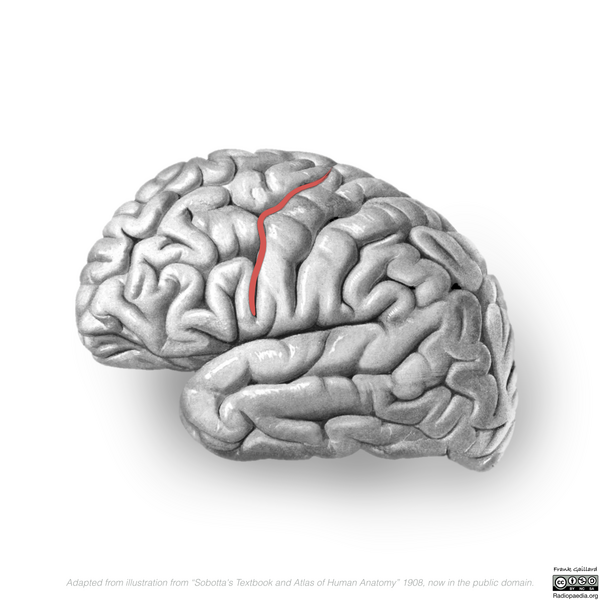 File:Neuroanatomy- lateral cortex (diagrams) (Radiopaedia 46670-51202 Precentral sulcus 6).png