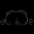 Normal MRI abdomen in pregnancy (Radiopaedia 88001-104541 Axial T2 1).jpg