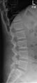 Normal lateral lumbar spine radiograph (Radiopaedia 46575).jpg