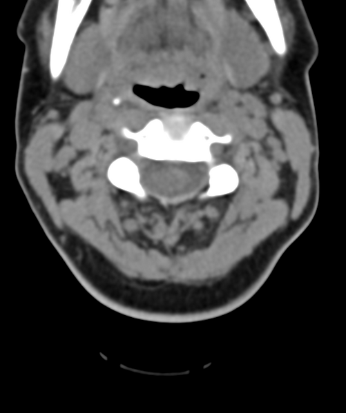 File:Normal cervical spine MRI (including Dixon) (Radiopaedia 42762-45926 Axial non-contrast 21).png