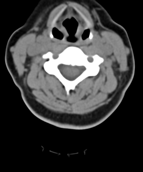 File:Normal cervical spine MRI (including Dixon) (Radiopaedia 42762-45926 Axial non-contrast 29).png