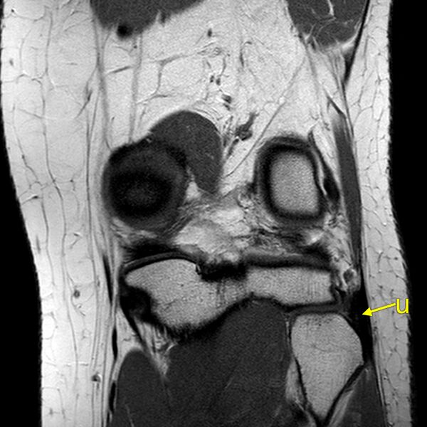 File:Anatomy Quiz (MRI knee) (Radiopaedia 43478-46874 A 23).jpeg