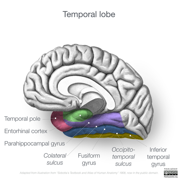 File:Neuroanatomy- medial cortex (diagrams) (Radiopaedia 47208-52697 Temporal lobe gyri 1).png