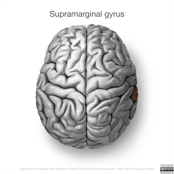 File:Neuroanatomy- superior cortex (diagrams) (Radiopaedia 59317-66671 Supramarginal gyrus 3).png