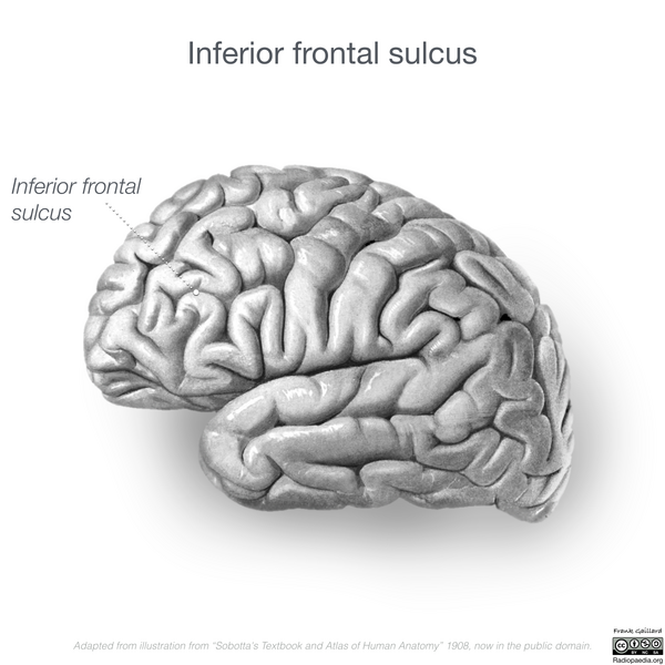 File:Neuroanatomy- lateral cortex (diagrams) (Radiopaedia 46670-51202 B 3).png