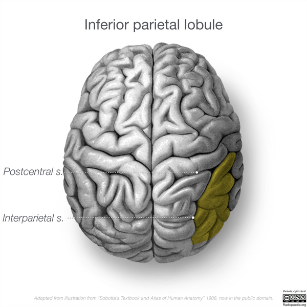 File:Neuroanatomy- superior cortex (diagrams) (Radiopaedia 59317-66671 D 3).png