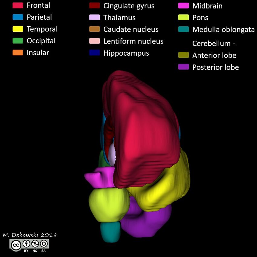 Brain lobes - annotated MRI (Radiopaedia 61691-69700 3D reconstruction 17).JPG