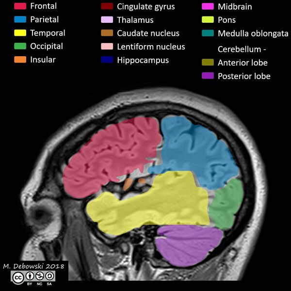 File:Brain lobes - annotated MRI (Radiopaedia 61691-69700 Sagittal 64).JPG