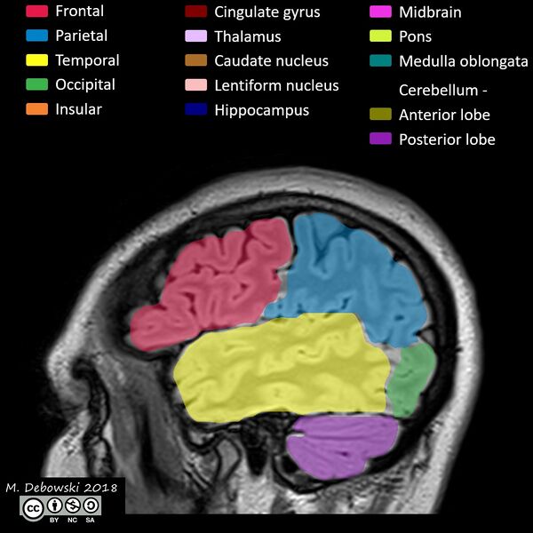 File:Brain lobes - annotated MRI (Radiopaedia 61691-69700 Sagittal 67).JPG