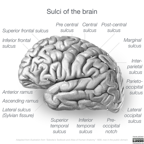 File:Neuroanatomy- lateral cortex (diagrams) (Radiopaedia 46670-51201 Brain 4).png