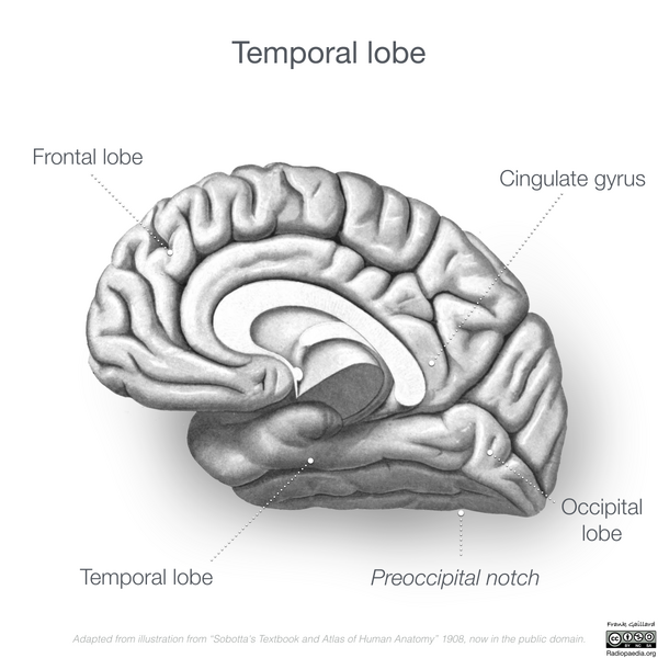 File:Neuroanatomy- medial cortex (diagrams) (Radiopaedia 47208-51763 F 1).png