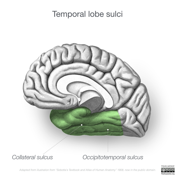 File:Neuroanatomy- medial cortex (diagrams) (Radiopaedia 47208-58969 H 2).png